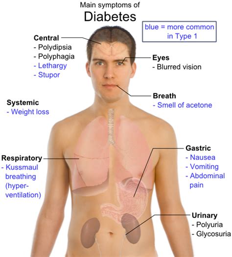 Diabetes Symptoms - Gluxus Health - COMFORTAID