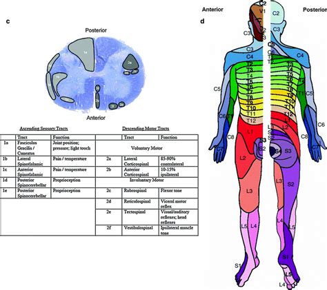 Cord And Peripheral Nervous System Radiology Key