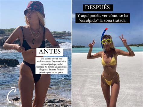 Teresa Andr S Gonzalvo Muestra El Antes Y El Despu S De Su Ltimo