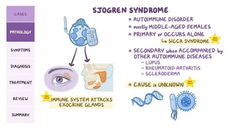 Sjogren Syndrome Pathology Review Osmosis