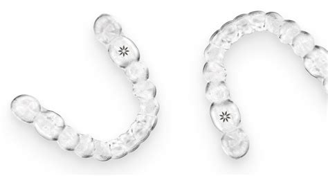 Living With Invisalign Clear Aligners Invisalign