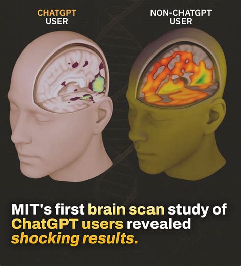The Clinical - 🧠 MIT recently completed the first brain-scan study on