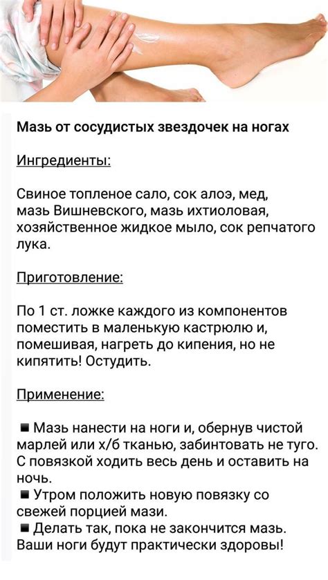 Мазь от сосудистых звездочек на ногах | Health skin care, Beauty skin ...