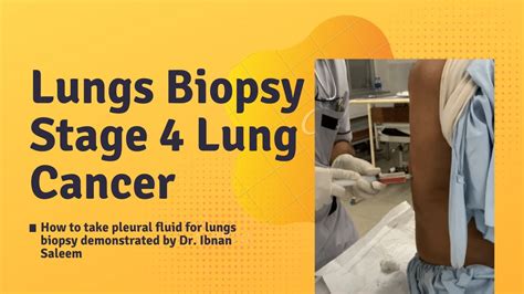 How To Take Pleural Fluid Sample Lungs Biopsy For Stage 4 Lungs Cancer Patient Youtube