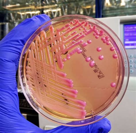 Klebsiella Pneumoniae On Macconkey Agar