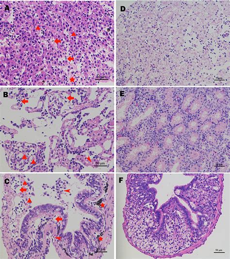 Klebsiella Pneumoniae Colony Morphology