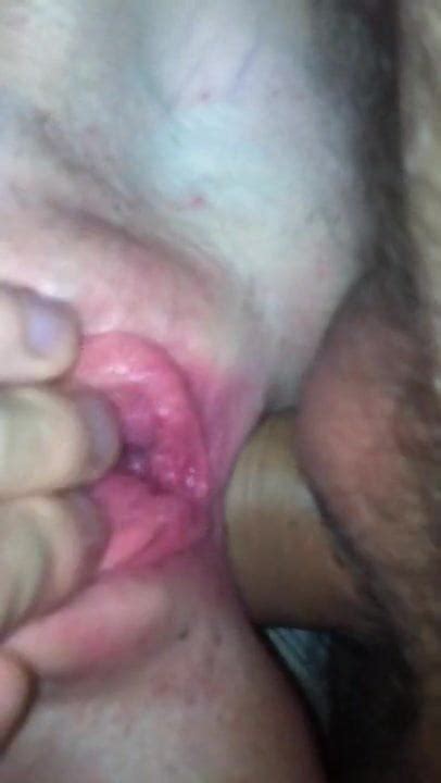 Anal Brit Girl Free British HD Porn Video 11 XHamster