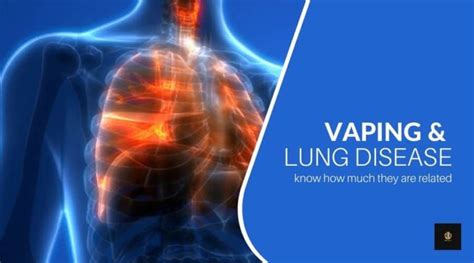 Vaping and Lung Disease: Know How Much They are Related