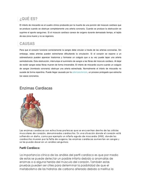 Enzimas Cardiacas Músculo Cardíaco Infarto Agudo De Miocardio