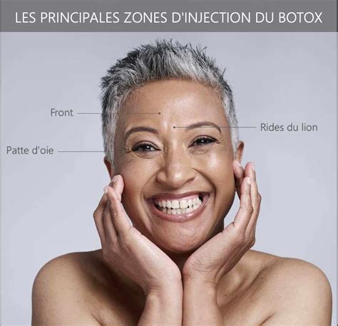 Les Choses Indispensables Savoir Sur Linjection De Botox Annecy