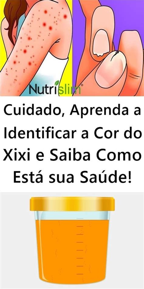 Cuidado Aprenda A Identificar A Cor Do Xixi E Saiba Como Est Sua