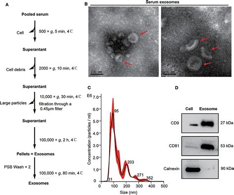 Frontiers Proteomic Profiling Of Serum Exosomes From Patients With