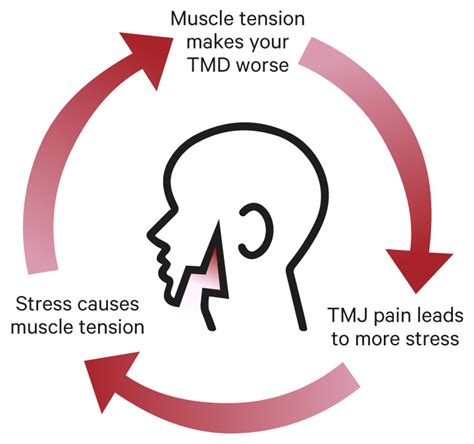 The Cycle Of Stress And Tmd Infinite Smiles Neal Patel D D S Inc