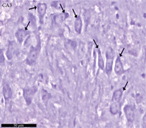 Photomicrographs of the hippocampus of albino rat from group III ... 