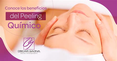 Conoce Los Beneficios Del Peeling Qu Mico Dr Oscar Gaona Medicina