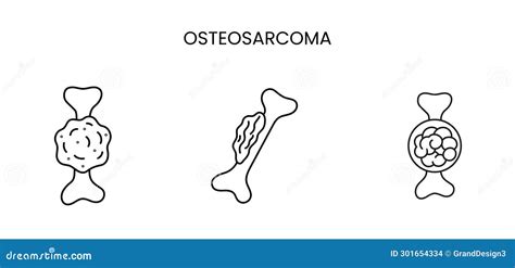 Cancer Osteosarcoma Line Icon Vector Cancer Malignant Disease Stock