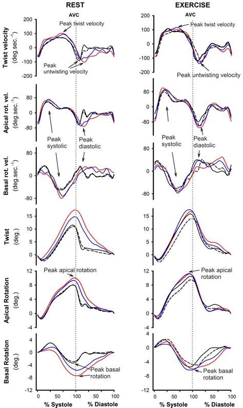 Graphical Representation Of Mean Left Ventricular Lv Twist Mechanics