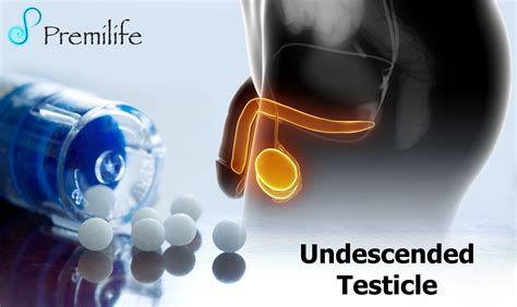 Undescended Testicle Premilife Homeopathic Remedies