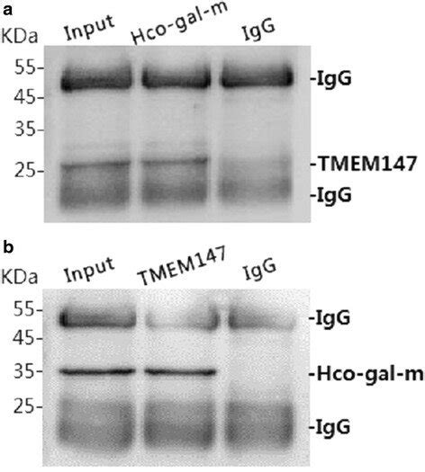 Co Ip Assays Indicate That Rhco Gal M Can Bind To Tmem147 Lane Input Download Scientific