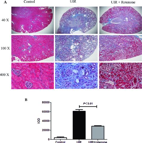 Rotenone Treatment Attenuated The Deposition Of Extracellular Matrixin