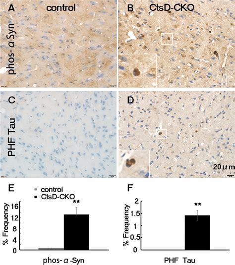 Increase Of Phosphorylated Synuclein And Hyper Phosphorylated Tau