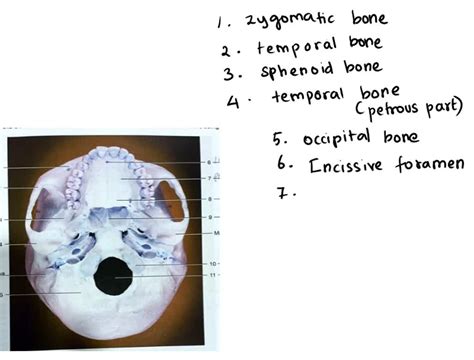 SOLVED Maxilla Ethmoid Bone Exercise 8 The Skeletal System