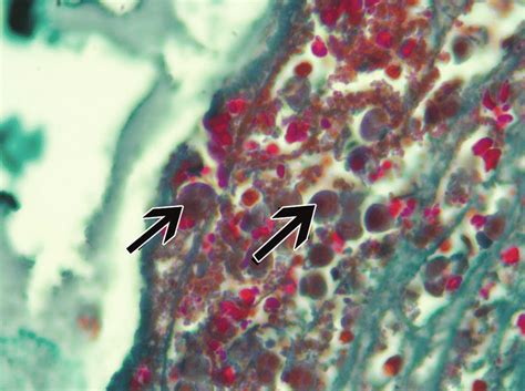 Entamoeba Histolytica Trophozoites As Shown With Arrows Massons Download Scientific Diagram