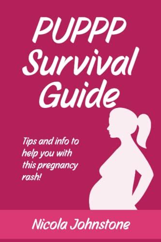 Puppp Survival Guide Tips And Info To Help You With This Pregnancy