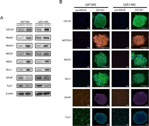 Cd133 U87 Mg And U251 Mg Human Gbm Formed Neurospheres Exhibit Higher