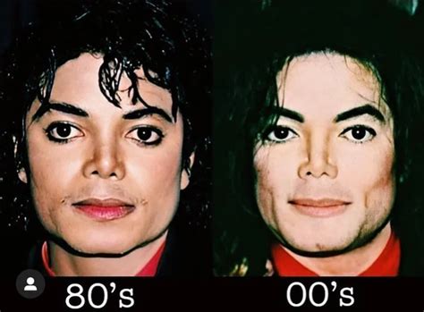 Michael Jackson Plastic Surgery: Exploring the Transformations