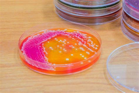 Bacterial Culture Growth On Agar Plate Stock Photo Image Of Colony