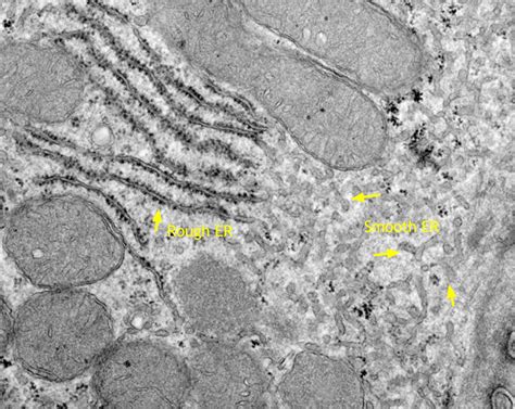 Endoplasmic Reticulum Electron Microscope