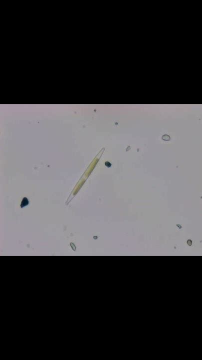 Pond Water Organisms Middleschool Science Youtube