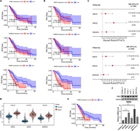 RRM2 Promotes Liver Metastasis Of Pancreatic Cancer By Stabilizing YBX1