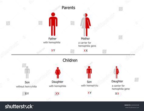 Hemophilia Inheritance Father Hemophilia Carrier Mother Stock