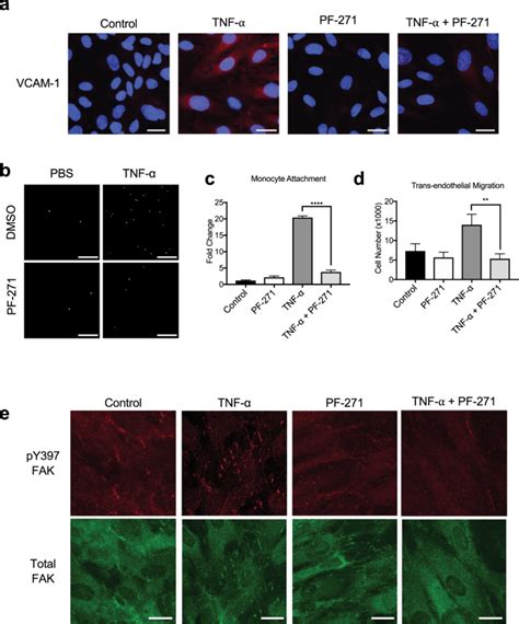 Fak And Pyk2 Activity Promote Tnf α And Il 1β Mediated Pro Inflammatory Gene Expression And