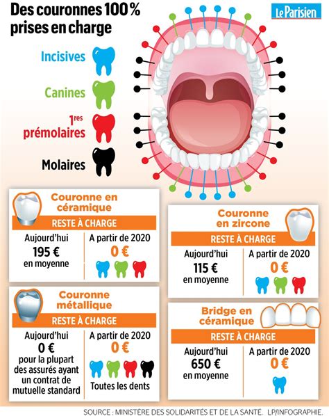 Quelle dent sont remboursés à 100 Votre Assurance