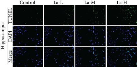 La exposure impaired the synaptic structure of hippocampal neurons and ... 