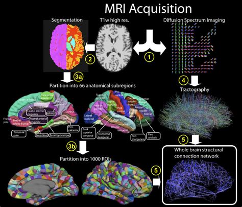 Extraction Of A Whole Brain Structural Connectivity Network 1 Download Scientific Diagram