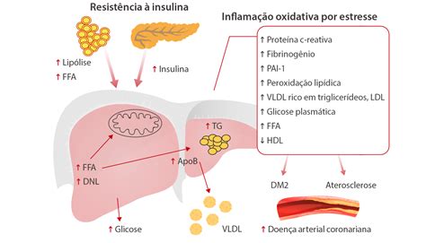 Dislipidemia diabética coisas que você precisa saber Mindray