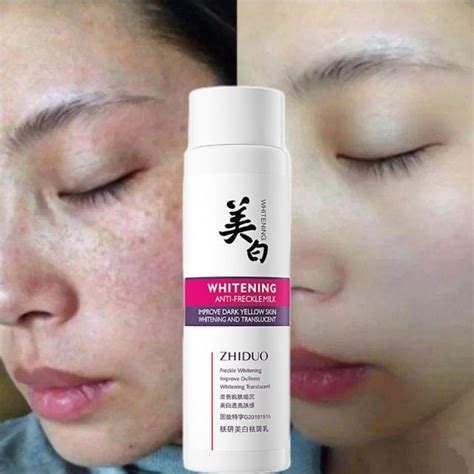 Whitening Freckle Cream Remove Dark Spots Melanin Melasma Cream