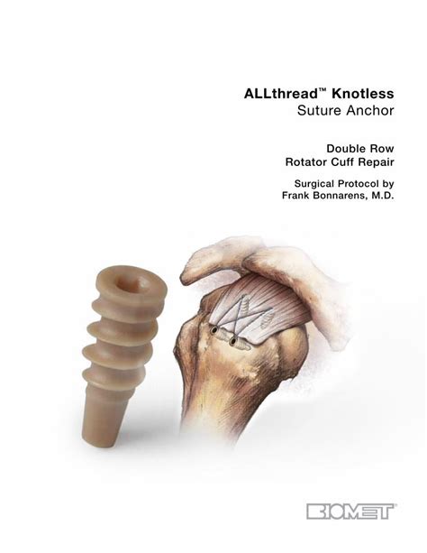 PDF ALLthread Knotless Suture Anchor Zimmer Biomet 2020 01 10