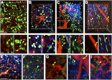 Neutrophil And Macrophage Distribution In Various Tissues Of Lysm Gfp