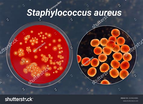 Bacteria Staphylococcus Aureus Colonies On Sheep Stock Illustration