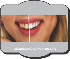 Advantages And Disadvantages Of Deep Cleaning Teeth