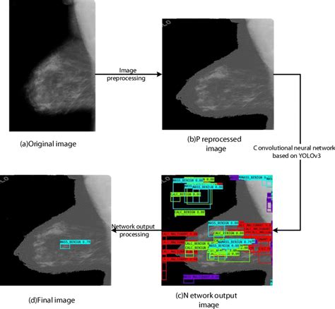 Flow Chart Of Our Computer Aided Diagnosis System Download Scientific Diagram