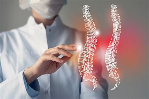 How Does Spinal Cord Stimulation Treat My Chronic Neuropathic Pain