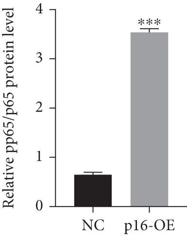 Steatosis Induced Or P Overexpression Aggravates Inflammaging