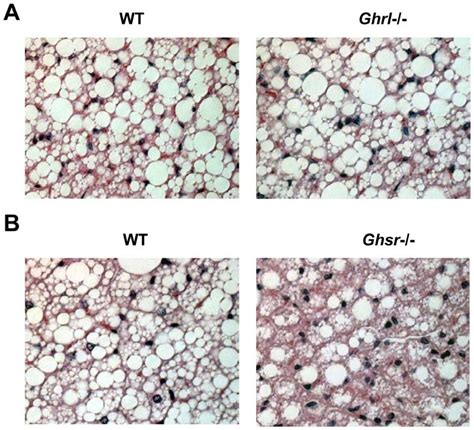 Morphology Of Interscapular Brown Adipose Tissue Bat Of Older Wt