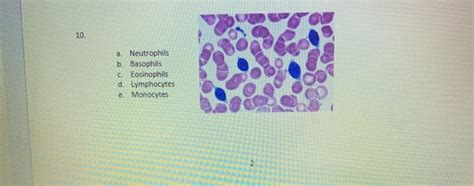 Solved A Neutrophils B Basophils Eosinophils D Chegg